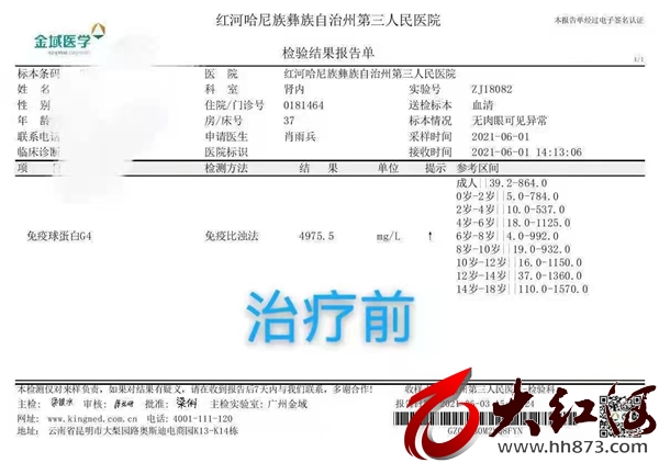 红河州第三医院成功诊治一例少见IgG4相关疾病 国内仅为个案报道