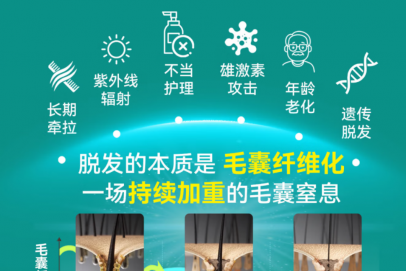 最新防脱成分安全&功效双维度排行榜：新型成分乌诺地尔上榜了